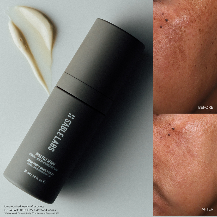 Sable Face S'ABLE Labs Skincare | Melanin-Inclusive Skincare – S'ABLE Labs UK