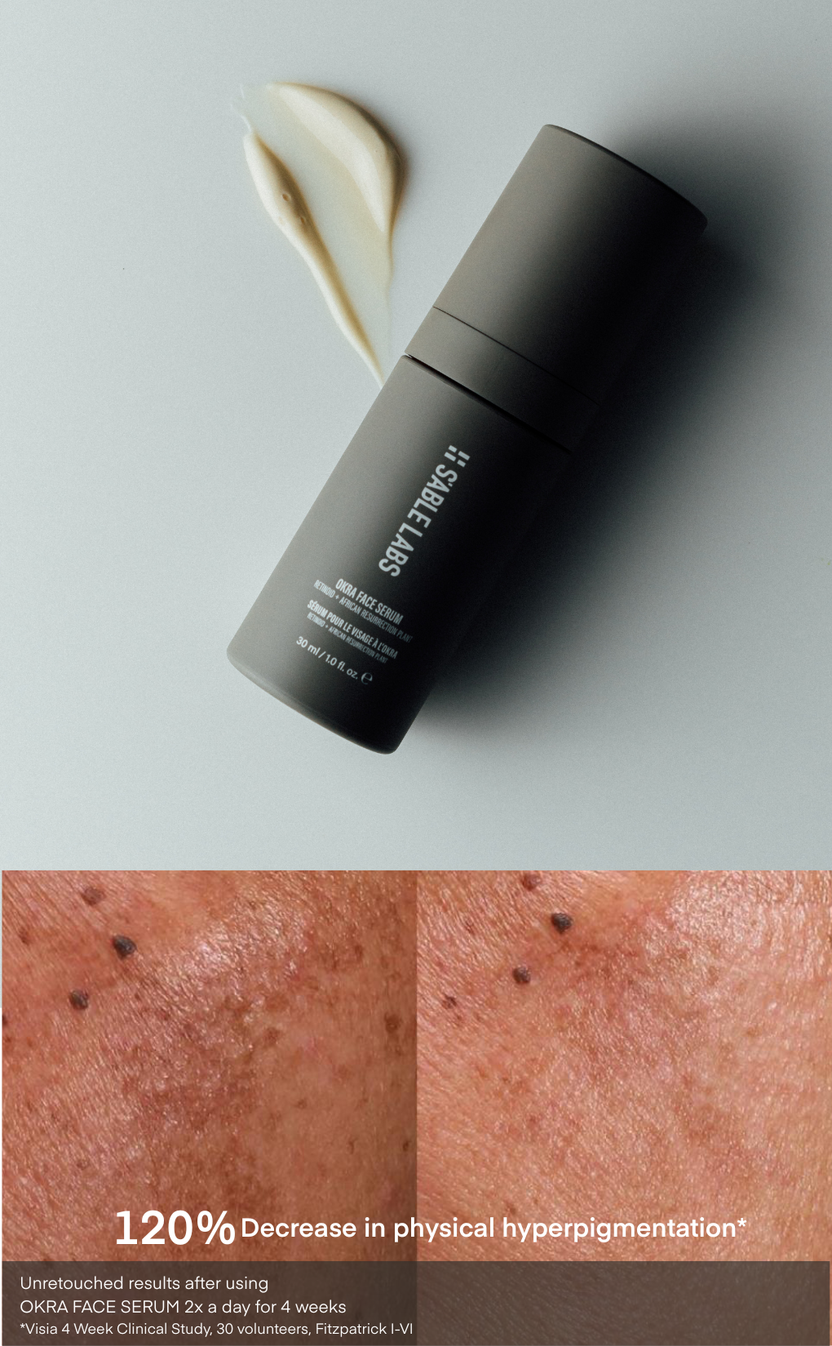 S'ABLE Labs Skincare | Melanin-Inclusive Skincare – S'ABLE Labs UK