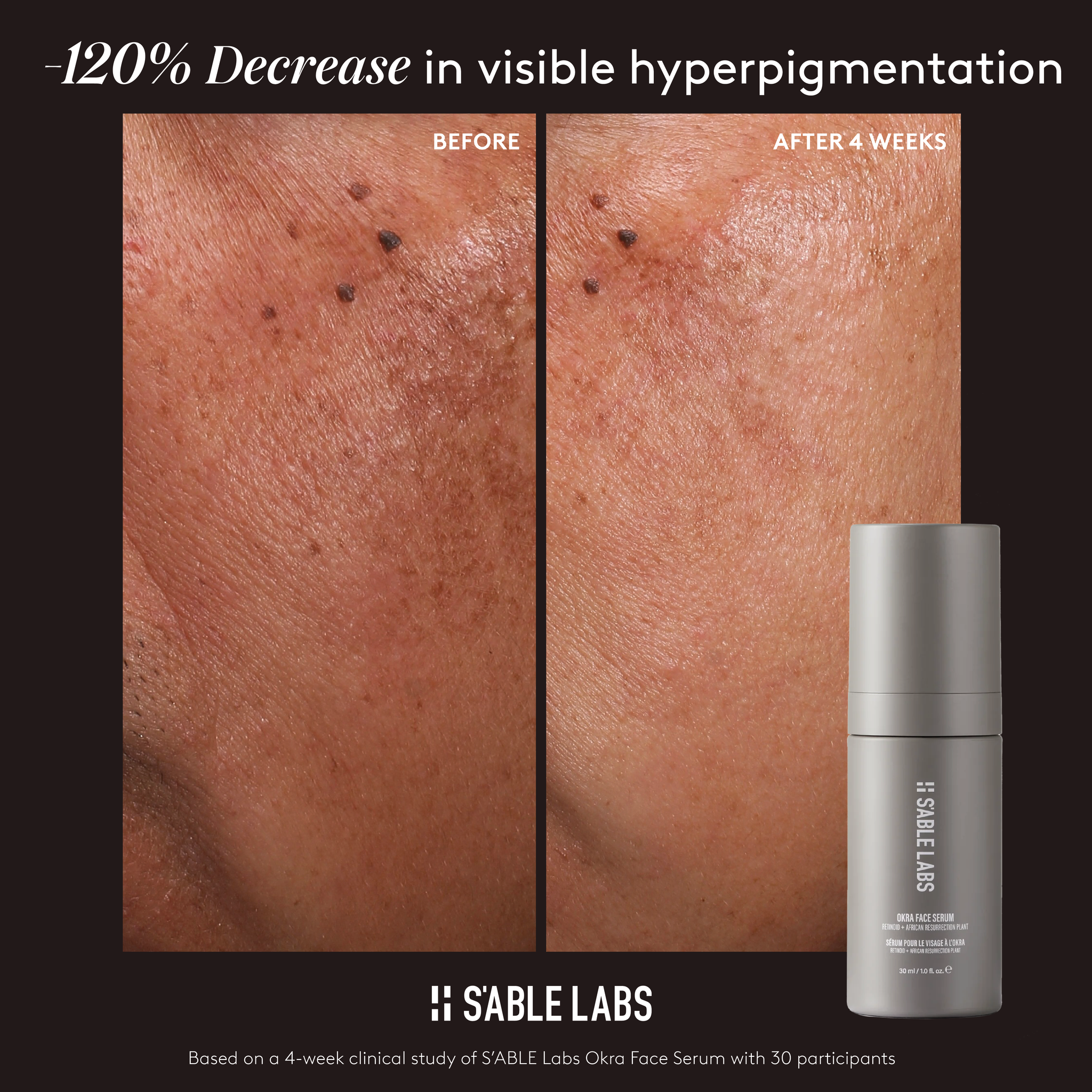 Sable Face Okra Face Serum | Hydrating & Nourishing Skincare | Sable Labs UK – S ...